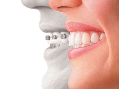21st Century Dental Care | Ceramic Crowns, Preventative Program and TMJ Disorders